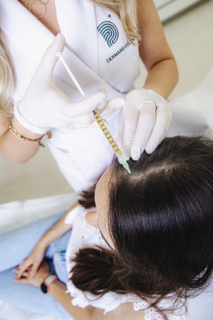Aplikácia prípravku do pokožky hlavy pri vlasovej mezoterapii na klinike Dermarevolta
