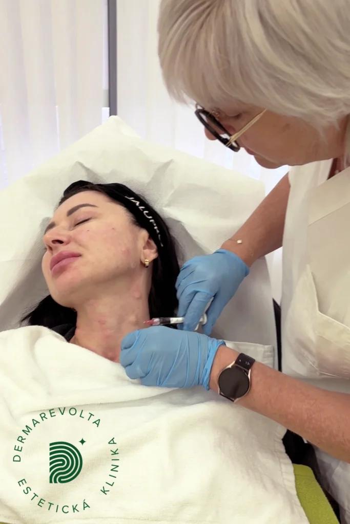 Aplikácia Profhilo krk injekčné omladenie pokožky krku Bratislava