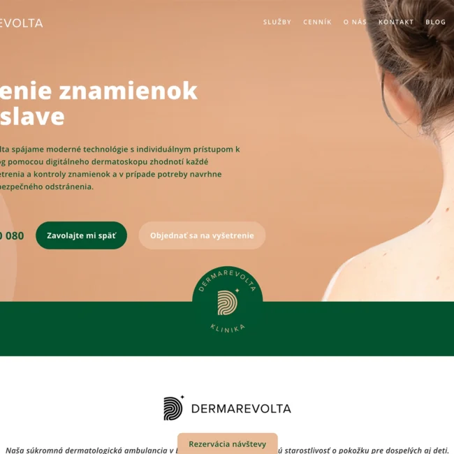 Vysetrenie znamienok