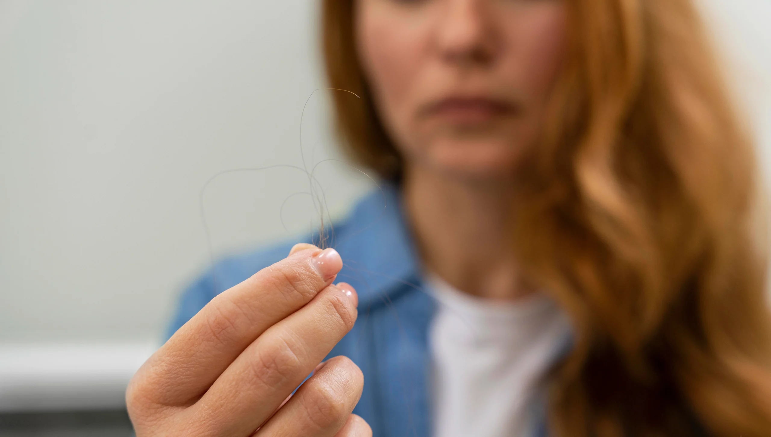 vypadavanie vlasov priciny liecba bratislava