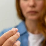 7 najčastejších príčin nadmerného vypadávania vlasov a moderné spôsoby ich liečby