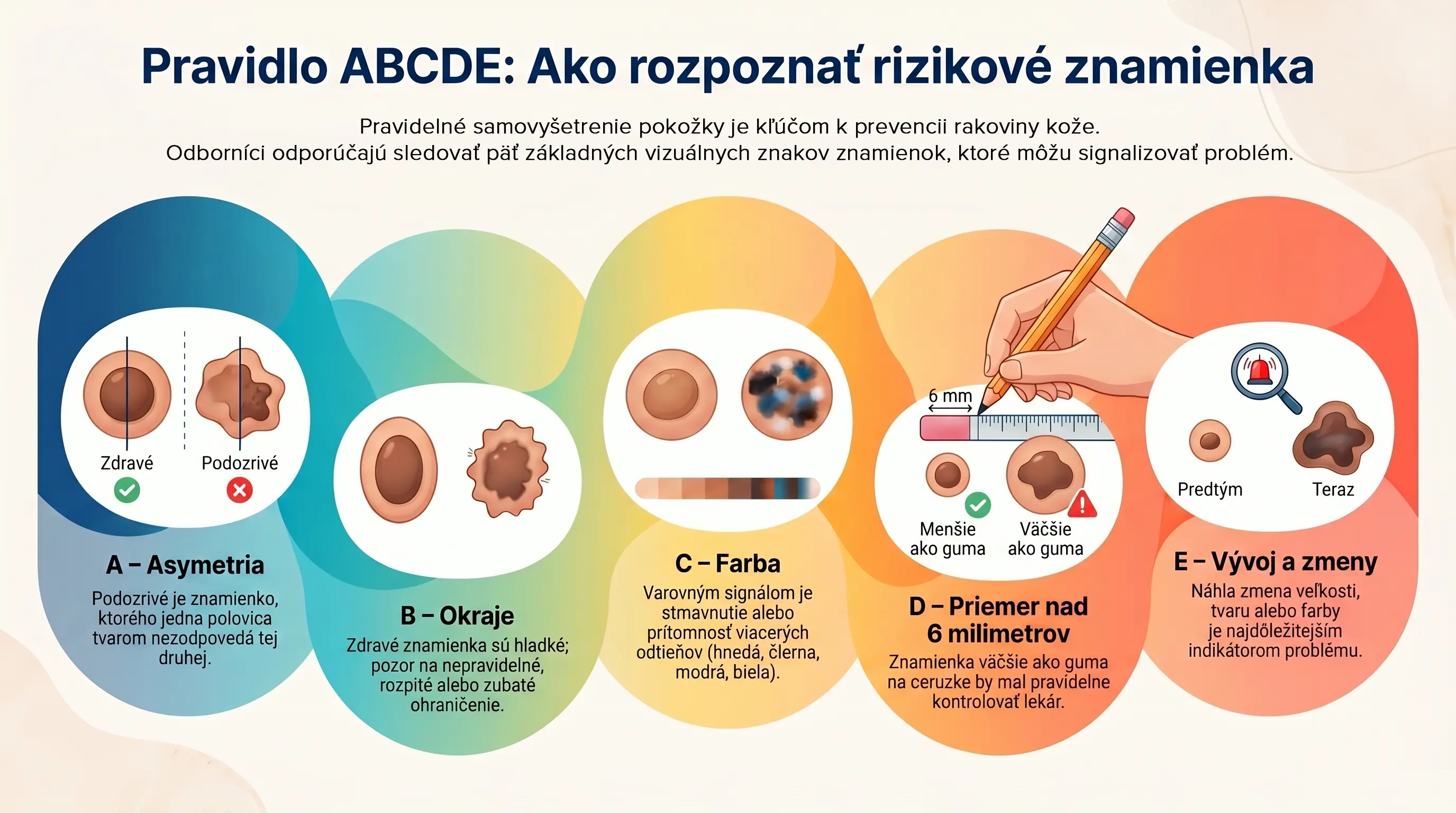 Infografika o pravidle ABCDE na rozpoznanie rizikových znamienok na koži. Vysvetľuje päť znakov: A – asymetria, B – nepravidelné okraje, C – zmena farby, D – priemer nad 6 mm, E – vývoj a zmeny