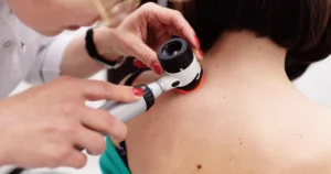 Dermatolog vysetruje znamienka pomocou dermatoskopu na diagnostiku melanomu