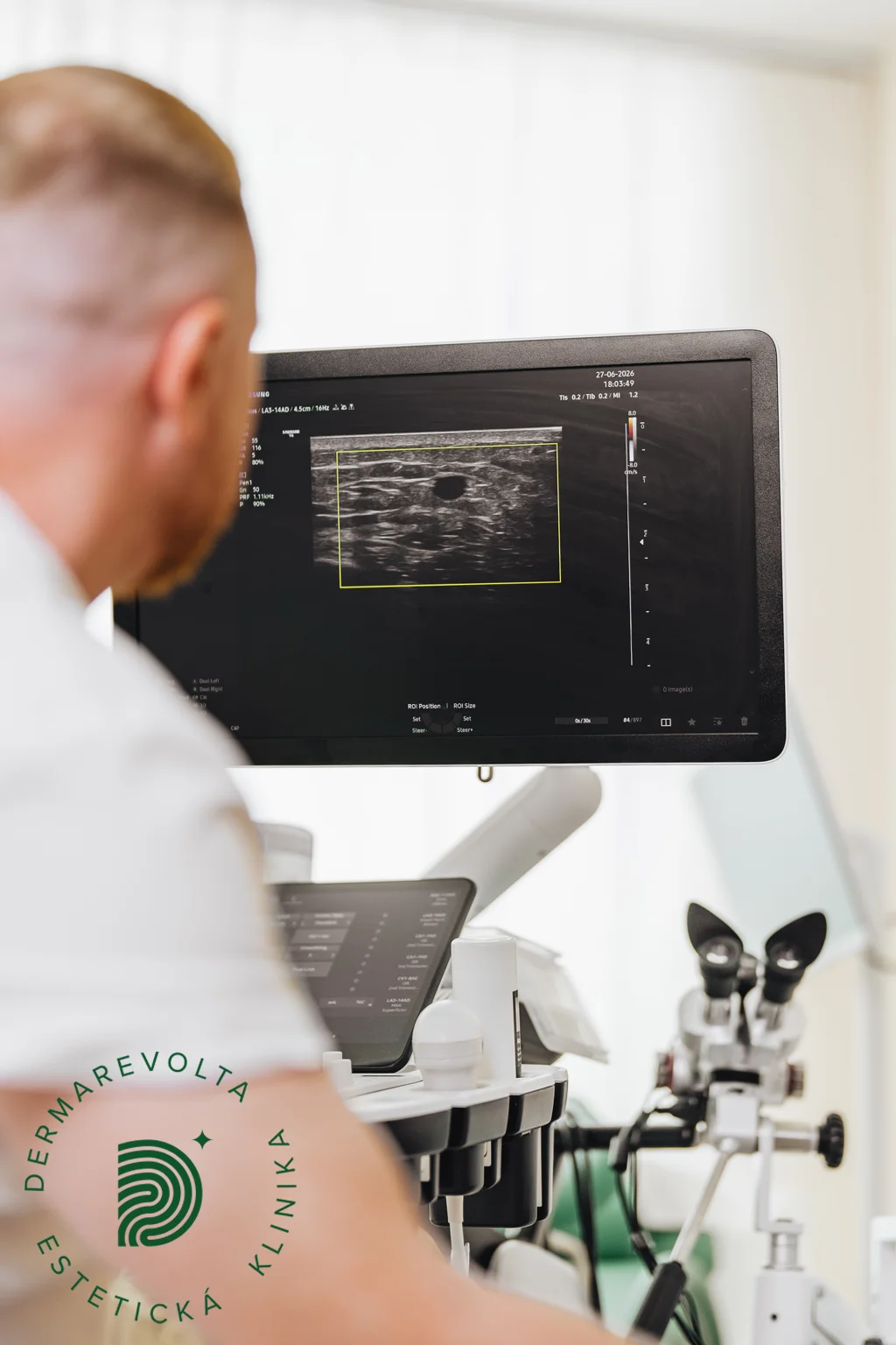Duplexné vyšetrenie žíl dolných končatín ultrazvukom na klinike Dermarevolta