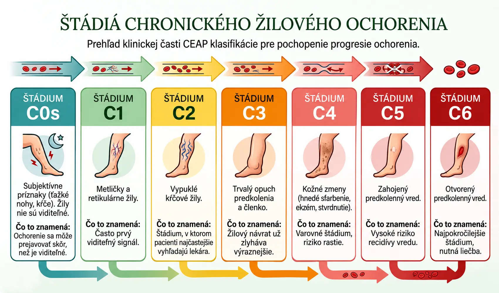 Štádiá chronického žilového ochorenia podľa klinickej klasifikácie CEAP od C0s po C6
