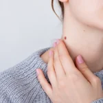 Samovyšetrenie znamienok doma: praktický postup a kedy ísť k dermatológovi