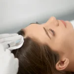 Vlasová mezoterapia alebo plazma (PRP): porovnanie pri vypadávaní vlasov